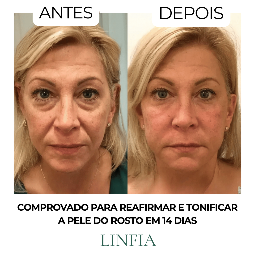 Escova para drenagem linfática
